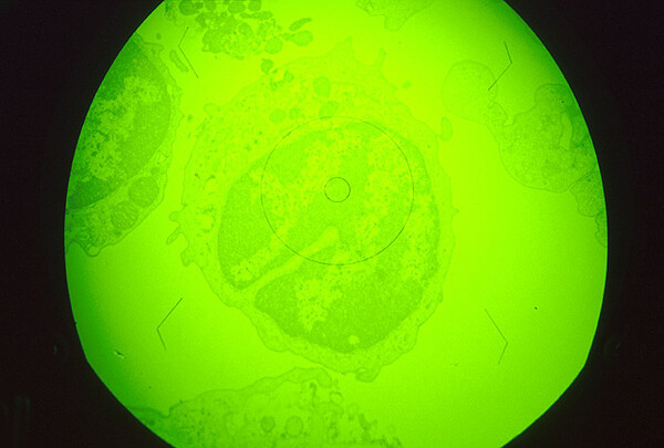 ▲ ASFV 감염 초기 단계의 대식세포 (사진 / USDA)